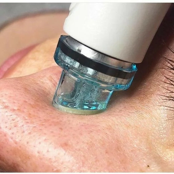 Hydra Vandens Dermabrazijos HydraFacial Aparatas 10in1 grozioplanas.lt