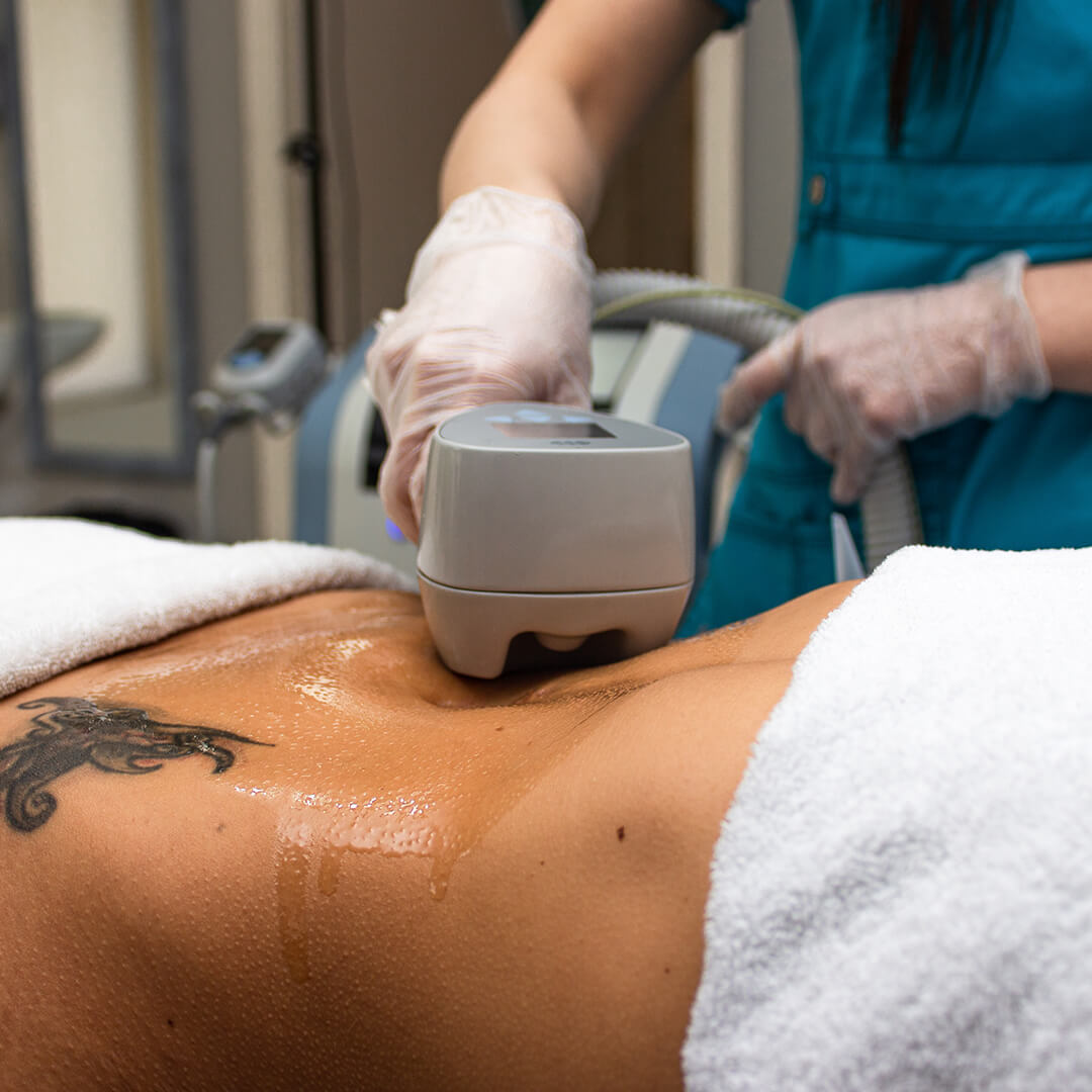 BTL EXILIS 360 ULTRA grožioplanas.lt