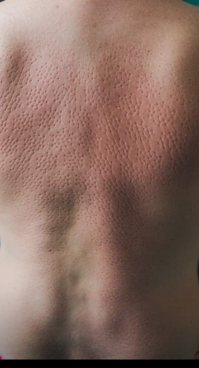 „sleep.ink“ akupresūros kilimėlis