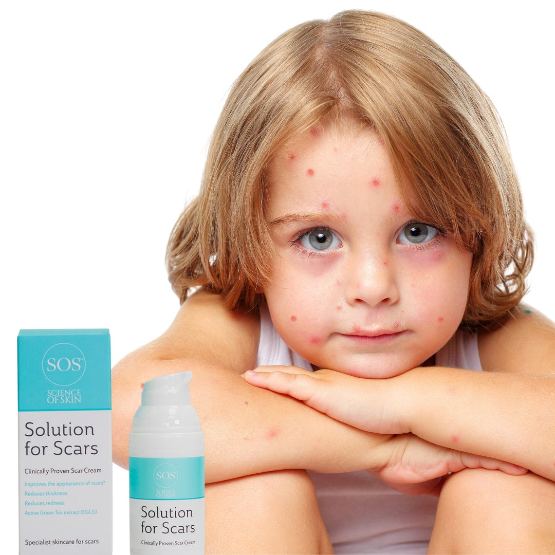 Solution for Scars Randu Gydimui - grožio-planas.lt