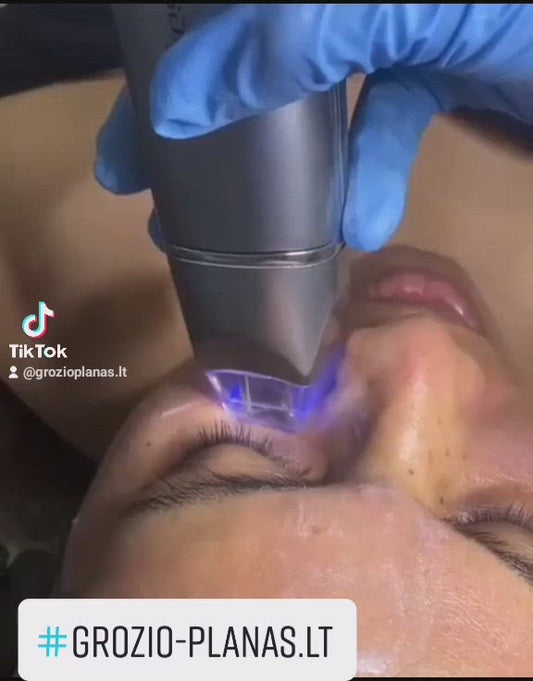 Elektrinis veido masazuoklis ems aparatas vakuuminis masazas grozioplanas.lt