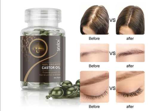 Plauku serumas aliejus skatina plauku augima grozioplanas.lt